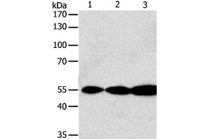 Western Blot analysis of Jurkat, Hela and A549 cell using GSR Polyclonal Antibody at dilution of 1:750 (Glutathione Reductase Antikörper)