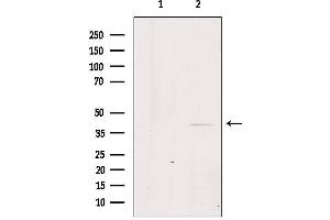 Western blot analysis of extracts from Hela, using GPR21 Antibody. (GPR21 Antikörper  (Internal Region))