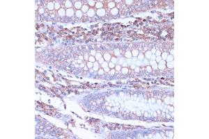 Immunohistochemistry of paraffin-embedded human colon using CD38 antibody (ABIN6130076, ABIN6138177, ABIN6138178 and ABIN6217677) at dilution of 1:100 (40x lens). (CD38 Antikörper  (AA 46-300))