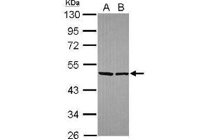 WB Image Sample (30 ug of whole cell lysate) A: Hela B: Hep G2 , 10% SDS PAGE antibody diluted at 1:10000 (EIF4A2 Antikörper)