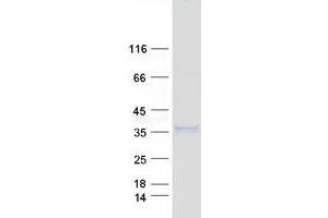 Western Blotting (WB) image for Nerve Growth Factor (NGF) protein (Myc-DYKDDDDK Tag) (ABIN2727242)