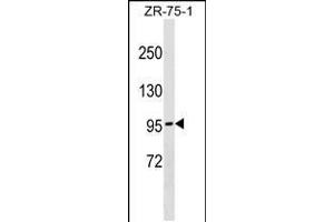 Western blot analysis in ZR-75-1 cell line lysates (35ug/lane). (NDST4 Antikörper  (N-Term))