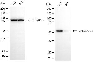 Western blotting analysis using anti-CALCOCO2 antibody (ABIN7797826).