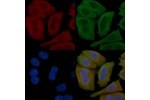 ABIN6258164 and ABIN6276015 staining Hela cells(45 min of heat-shock) by IF/ICC.