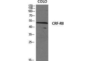 Western Blot (WB) analysis of specific cells using CRF-RII Polyclonal Antibody.