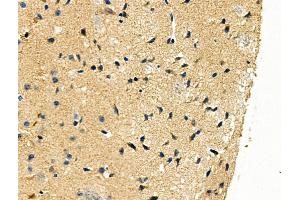 ABIN6262442 and ABIN6276447 at 1/100 staining Mouse brain tissue by IHC-P. (Id2 Antikörper  (C-Term))