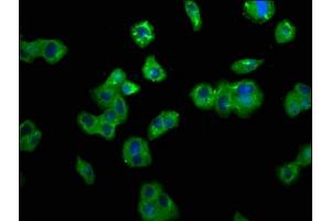 Immunofluorescence staining of HepG2 cells with ABIN7173829 at 1:200, counter-stained with DAPI. (TNFRSF1B Antikörper  (AA 56-210))