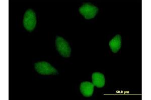 Immunofluorescence of purified MaxPab antibody to PRMT7 on HeLa cell.