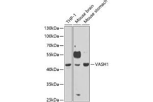 Western blot analysis of extracts of various cell lines, using V antibody (ABIN6128153, ABIN6150061, ABIN6150063 and ABIN6221754) at 1:1000 dilution.