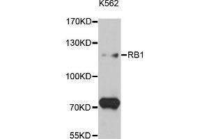 Western blot analysis of extracts of K-562 cells, using RB1 antibody (ABIN5995517) at 1:3000 dilution. (Retinoblastoma 1 Antikörper)