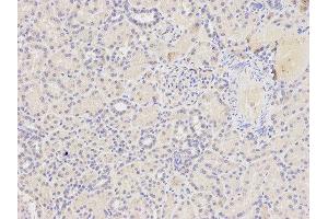 Immunohistochemistry of paraffin-embedded human kidney using FAS antibody at dilution of 1:400 (200x lens).