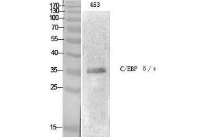 Western Blot (WB) analysis of specific cells using C/EBP epsilon Polyclonal Antibody. (CEBPE Antikörper  (Ser2448))