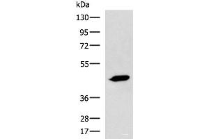 Western blot analysis of A431 cell lysate using ASB10 Polyclonal Antibody at dilution of 1:800 (ASB10 Antikörper)