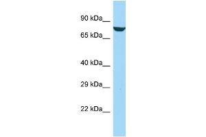 Host: Rabbit Target Name: AFAP1L1 Sample Type: Jurkat Whole Cell lysates Antibody Dilution: 1. (AFAP1L1 Antikörper  (C-Term))