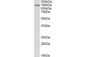 ABIN2563702 (2µg/ml) staining of Human Cerebellum lysate (35µg protein in RIPA buffer). (LMTK2 Antikörper  (Internal Region))