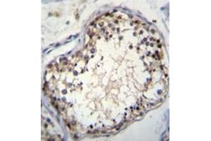 Immunohistochemistry analysis in formalin fixed and paraffin embedded human testis tissue reacted with OVOS Antibody (N-term) Cat. (OVOS1 (AA 57-87), (N-Term) Antikörper)