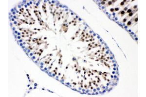 Immunohistochemistry (Paraffin-embedded Sections) (IHC (p)) image for anti-Cell Division Cycle 6 Homolog (S. Cerevisiae) (CDC6) (AA 147-549) antibody (ABIN3043500) (CDC6 Antikörper  (AA 147-549))
