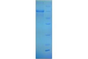 SDS-PAGE (SDS) image for Paraneoplastic Ma Antigen Family Member 5 (PNMA5) (AA 4-442), (partial) protein (His-SUMO Tag) (ABIN5711694)