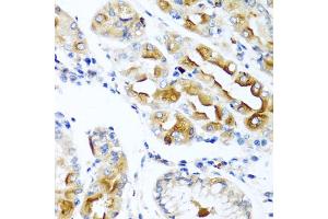 Immunohistochemistry of paraffin-embedded human stomach using CCL21 antibody. (CCL21 Antikörper)