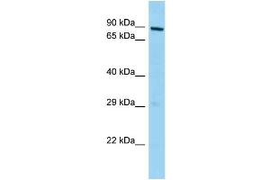 WB Suggested Anti-Mphosph10 Antibody Titration: 1. (MPHOSPH10 Antikörper  (C-Term))