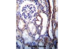 Immunohistochemistry (Paraffin-embedded Sections) (IHC (p)) image for anti-ATPase, H+ Transporting, Lysosomal 56/58kDa, V1 Subunit B1 (ATP6V1B1) (AA 291-318), (Middle Region) antibody (ABIN950569)
