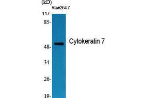 Western Blot (WB) analysis of specific cells using Cytokeratin 7 Polyclonal Antibody. (Cytokeratin 7 Antikörper  (C-Term))