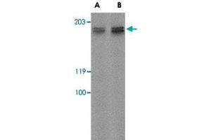 Western blot analysis of GPR124 in rat kidney tissue lysate with GPR124 polyclonal antibody  at (A) 2 ug/mL and (B) 4 ug/mL .