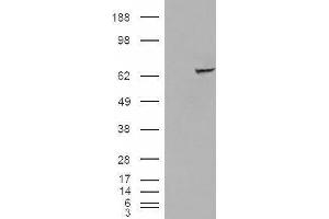 Western Blotting (WB) image for Insulin-Like Growth Factor 2 mRNA Binding Protein 2 (IGF2BP2) peptide (ABIN369348) (Insulin-Like Growth Factor 2 mRNA Binding Protein 2 (IGF2BP2) Peptid)