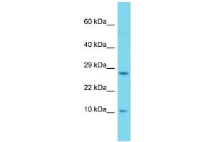 Western Blotting (WB) image for anti-SH2 Domain Containing 1A (SH2D1A) (Middle Region) antibody (ABIN2774285)