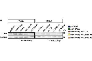 LDHB plays dual roles in MCPyV+ and MCPyV- MCC cells.
