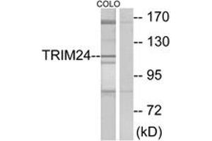Western blot analysis of extracts from COLO cells, using TRIM24 Antibody. (TRIM24 Antikörper  (AA 1001-1050))