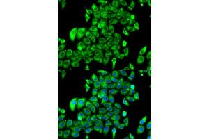Immunofluorescence analysis of MCF7 cell using RPL13 antibody. (RPL13 Antikörper)