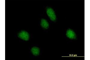 Immunofluorescence of purified MaxPab antibody to REPS1 on HeLa cell. (REPS1 Antikörper  (AA 1-653))