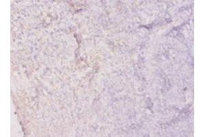 Immunohistochemistry of paraffin-embedded human tonsil tissue using ABIN7156020 at dilution of 1:20 (HPRT1 Antikörper  (AA 2-218))