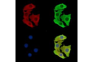 ABIN7097067 and ABIN7101134 staining Hela cells by IF/ICC. (TMEM63C Antikörper)
