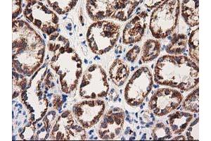 Immunohistochemical staining of paraffin-embedded Human Kidney tissue using anti-MMAA mouse monoclonal antibody. (MMAA Antikörper)