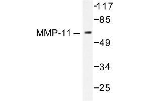 Image no. 1 for anti-Matrix Metallopeptidase 11 (Stromelysin 3) (MMP11) antibody (ABIN265523) (MMP11 Antikörper)