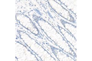 Immunohistochemistry of paraffin-embedded Human colon (negative control sample) using CD147/BSG antibody (ABIN7265838) at dilution of 1:100 (40x lens). (CD147 Antikörper)