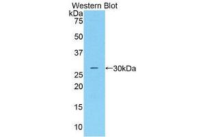 Western Blotting (WB) image for anti-Complement Factor D (CFD) (AA 1-263) antibody (ABIN1858380) (Adipsin Antikörper  (AA 1-263))