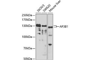 Western blot analysis of extracts of various cell lines, using B1 antibody (ABIN6129916, ABIN6136962, ABIN6136963 and ABIN6222795) at 1:1000 dilution. (AP3B1 Antikörper  (AA 895-1094))