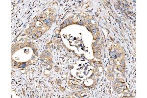 IHC analysis of MRP3/ABCC3 using anti-MRP3/ABCC3 antibody (ABIN7600647).