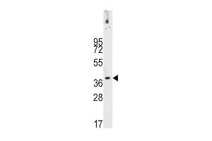 Western blot analysis of anti-PDX1 Antibody (T11) (ABIN388774 and ABIN2839109) in NCI- cell line lysates (35 μg/lane). (PDX1 Antikörper  (AA 1-30))