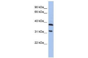 ASPA antibody used at 1 ug/ml to detect target protein. (ASPA Antikörper)