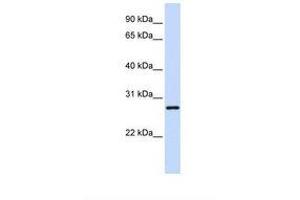 Image no. 1 for anti-TGFB-Induced Factor Homeobox 2-Like, X-Linked (TGIF2LX) (AA 146-195) antibody (ABIN6739117) (TGIF2LX Antikörper  (AA 146-195))