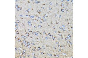 Immunohistochemistry of paraffin-embedded rat brain using R Rabbit mAb (ABIN7269840) at dilution of 1:100 (40x lens). (RALBP1 Antikörper)