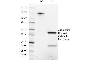 SDS-PAGE Analysis Purified CD8A Mouse Monoclonal Antibody (C8/1035).