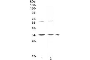 Western blot testing of human 1) HeLa and 2) SW620 cell lysate with IL12 p35 antibody at 0. (IL12A Antikörper)