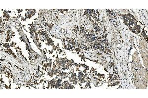 IHC analysis of FLCN using anti-FLCN antibody (ABIN7602491).