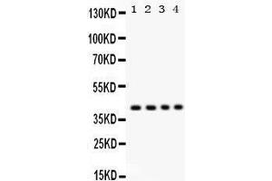 Western Blotting (WB) image for anti-Parvin, alpha (PARVA) (AA 155-185), (Middle Region) antibody (ABIN3043590) (Parvin alpha Antikörper  (Middle Region))