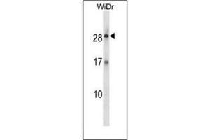 Western blot analysis of KLK12 / Kallikrein-12 Antibody (Center) in WiDr cell line lysates (35ug/lane).